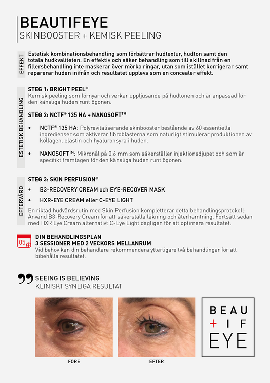 NCTF® +1 Start Kit (Beautif-EYE)